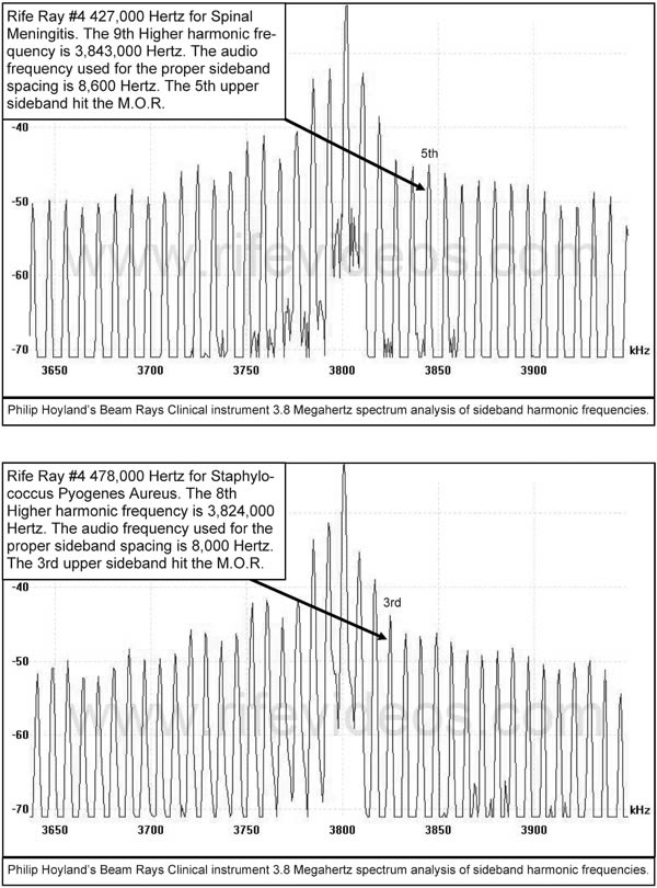 Rife Machine Spinal Meningitis and Staphylococcus Pyogenes Aureus